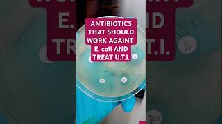 The antibiotics are AMIKACINAK MEROPENEMMEM CIPROFLOXACINCIP TAZOBACTAMTZP AND GENTAMICINCN [upl. by Swithin609]