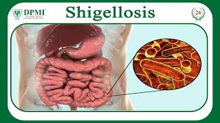 Shigellosis What Causes Shigellosis Shigella Morphology Classification Transmission amp Treatment [upl. by Witte]