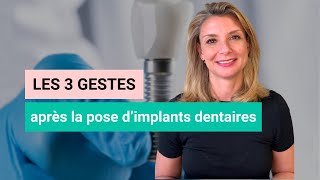 Implants Dentaires 3 Conseils Clés à Adopter Après la Pose [upl. by Ahsar621]