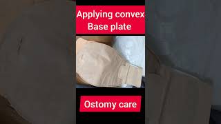 Stoma bag applied [upl. by Rupert526]