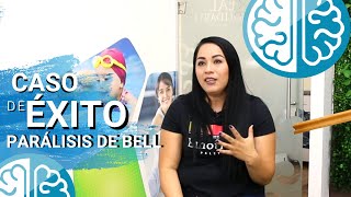 TRATAMIENTO de PARALISIS de BELL ► ¿Qué ejercicios hacer 😚¡CASO DE ÉXITO Fisioterapia Guadalajara [upl. by Nadnerb815]