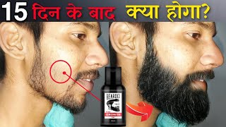 Beardo Hair Growth Oil After 15 Days Review  Best Beard Oil For Patchy Beard in India 2022 [upl. by Bonny985]