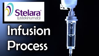 Stelara Infusion Process Ulcerative Colitis Treatment [upl. by Elfrida544]