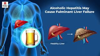 What is Fulminant Hepatitis  Fulminant Hepatic Failure  Hepatitis [upl. by Nylaret639]