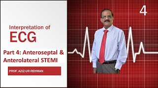 ECG Part 4 Anteroseptal amp Anterolateral STEMI final [upl. by Edwards]