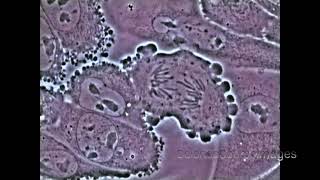 Mitosis in an animal cell Under the Microscope [upl. by Pelage986]