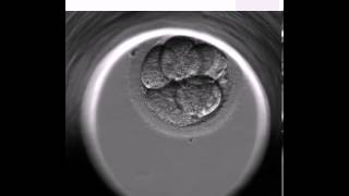 BONITO EMBARAZO CON EMBRYOSCOPE [upl. by Yelkrab171]