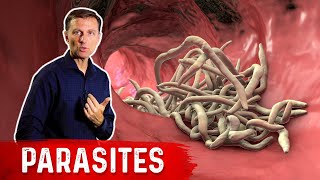 The Best Herbs for Parasites [upl. by Acenom314]