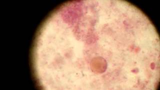 Blastocystis hominis Trophozoite [upl. by Roberts446]