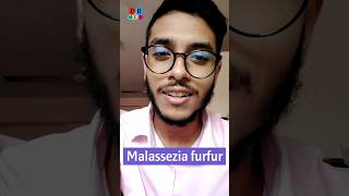 Dandruff  খুশকি  Fungal infection  Malassezia furfur  Dr Med  Sakib Rahaman [upl. by Yrroc806]