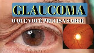 GLAUCOMA o que é e quais os seus sintomas  Dr André Wambier [upl. by Nnyltiak689]