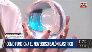 Cómo funciona el balón gástrico que se ingiere y se elimina solo [upl. by Tybie]