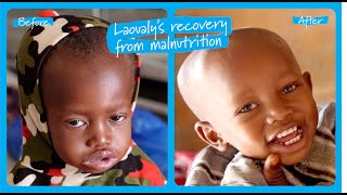 Laoualy’s recovery from severe malnutrition in Niger  UNICEF [upl. by Maryann]