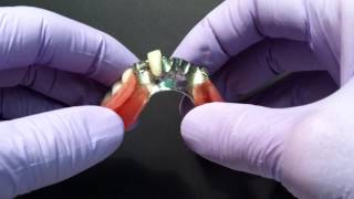 Soft Lining for Partial Dentures [upl. by Adna989]