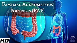 Familial Adenomatous Polyposis  FAP Everything You Need To Know [upl. by Arama421]