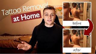 Home Tattoo Removal How to REMOVE a Tattoo at Home Painless amp Without Laser  With Before amp After [upl. by Nylac]