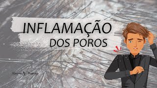 CASPA  UMA INFLAMAÇÃO DOS POROS [upl. by Hank579]