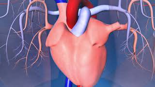 Catheter Ablation What is it and how does it help an irregular heart beat [upl. by Niar821]