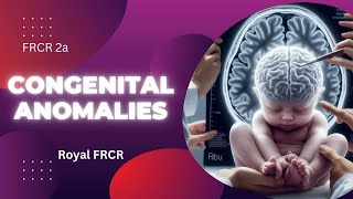 2  Neuroimaging for FRCR [upl. by Cornwall]