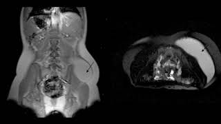 Difference Between Hyperventilation and Tachypnea [upl. by Sadler]