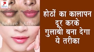 होठों का कालापन दूर करके गुलाबी बना देगा ये तरीका  Pink Lips Remedies Tips [upl. by Elyrpa]