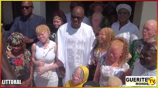 🔶️ Inauguration de la deuxième maison africaine de lenfant albinos  LOFB soutenue par la [upl. by Nohsar]