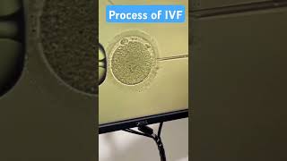 Process of IVF  Infertility process [upl. by Neile]