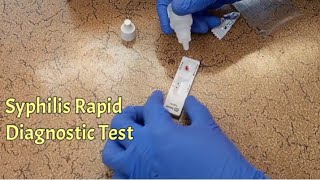 How To Use Syphilis Rapid Diagnostic Test  VDRL Test [upl. by Neerac]