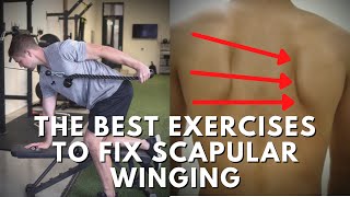 Effective Exercises To Fix Scapular Winging  Targeting The Weak Muscles [upl. by Naples]