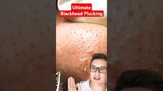 Crazy Satisfying BLACKHEAD PLUCKING  You Will Love This shorts [upl. by Royce]