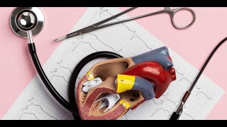 Anomalous Origin of Coronary Arteries from Opposite Situs and the Conundrum of Sudden [upl. by Ecirb]