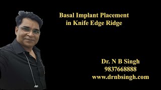 basal implant placement in knife edge ridge  Dr NBsinghmp4 [upl. by Sualokcin]