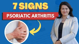 Psoriatic Arthritis 7 Signs and Symptoms  A Rheumatologist Review [upl. by Florio]