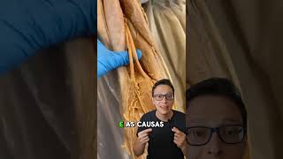 Nervo Ciático 😮🦵 curiosidades enfermagem medicina medico saude enfermeira anatomia ciatico [upl. by Schuyler]