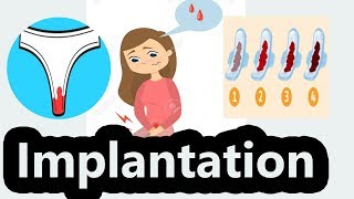 Implantation bleeding signs symptoms and what it means [upl. by Ahsiekim]