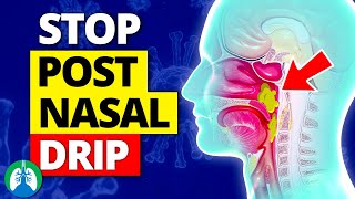 Top 10 Ways to Stop a Cough from Postnasal Drip [upl. by Adiasteb]