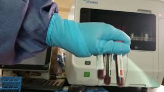 Hematology Performing and Interpreting QC on the Sysmex XN550 Automated CBC Analyzer [upl. by Pearman]