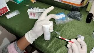 POC Test For SICKLE CELL Disease confirmation HemotypeSC test [upl. by Nnylak926]