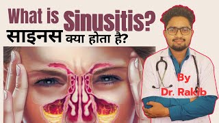 sinusitis treatment sinusitis kya haisinusitis ki symptoms sinusitis ki hoi sinusitis ki ilaj [upl. by Lette839]