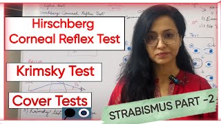 Strabismus Part 2  Hirschberg Corneal Reflex Test  Krimsky Test  Cover Tests [upl. by Uni919]