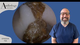 5 X EAR WAX REMOVAL COMPILATION  EP723 [upl. by Madelin]