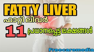 Fatty liver symptoms malayalam  liverdisease liver liverdiseasesymptoms [upl. by Cantlon]