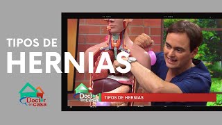 Tipos de hernias [upl. by Haniraz]