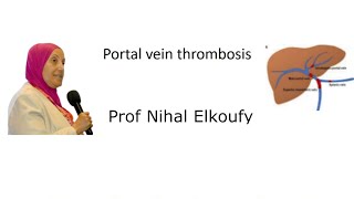 Portal Vein Thrombosis Prof Nihal Elkoufy [upl. by Ythomit904]