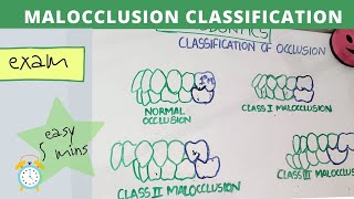 malocclusion of teeth I orthodontics lecture [upl. by Enillebyam268]