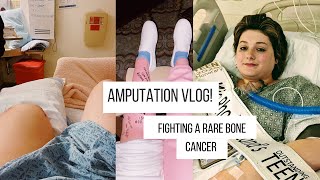 Amputation Vlog fighting a rare bone cancer [upl. by Kathi]