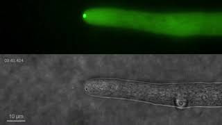 Spitzenkörper in filamentous fungus Neurospora crassa [upl. by Ij]