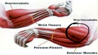 Treatment and Causes of Forearm Pain [upl. by Vevay160]