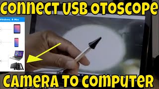 How to connect USB Otoscope Ear Scope Camera To computer [upl. by Wieren]