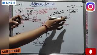 Atherosclerosis pathophysiology in detail  PG syllabus  GEETARU Shanjalii  KayachikitsaAyurved [upl. by Naman75]